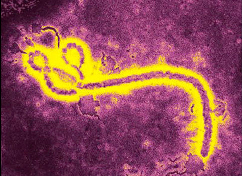 Eix. Virus de l'Ebola